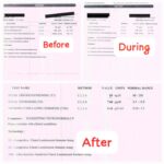 Efficacy of Homeopathy in Treating Hypothyroidism