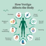 Acute Case Of Vertigo Cured with Homoeopathy