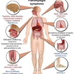 Fibromyalgia Well Managed with Homeopathy!!!